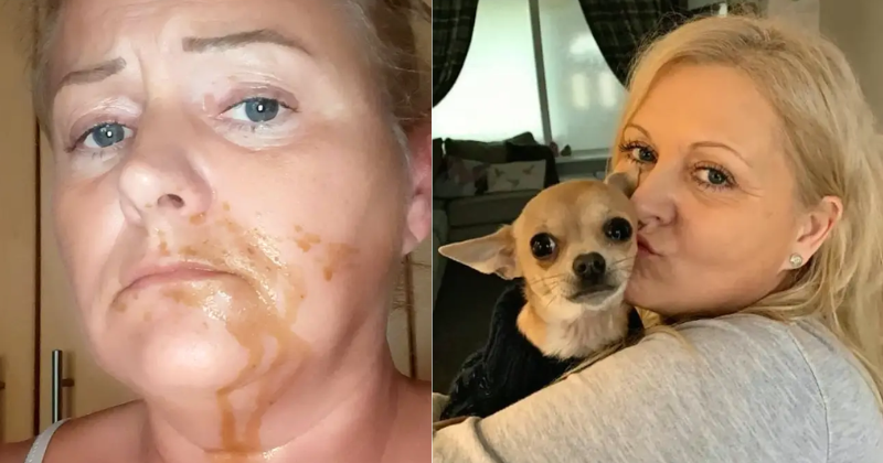 Woman Spends 3 Days In Hospital After Her Pet Dog Pooped On Her face While She Was Asleep